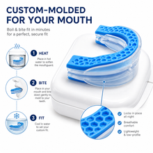 Load image into Gallery viewer, Anti snore custom molding mouthguard - Prevents snoring fast
